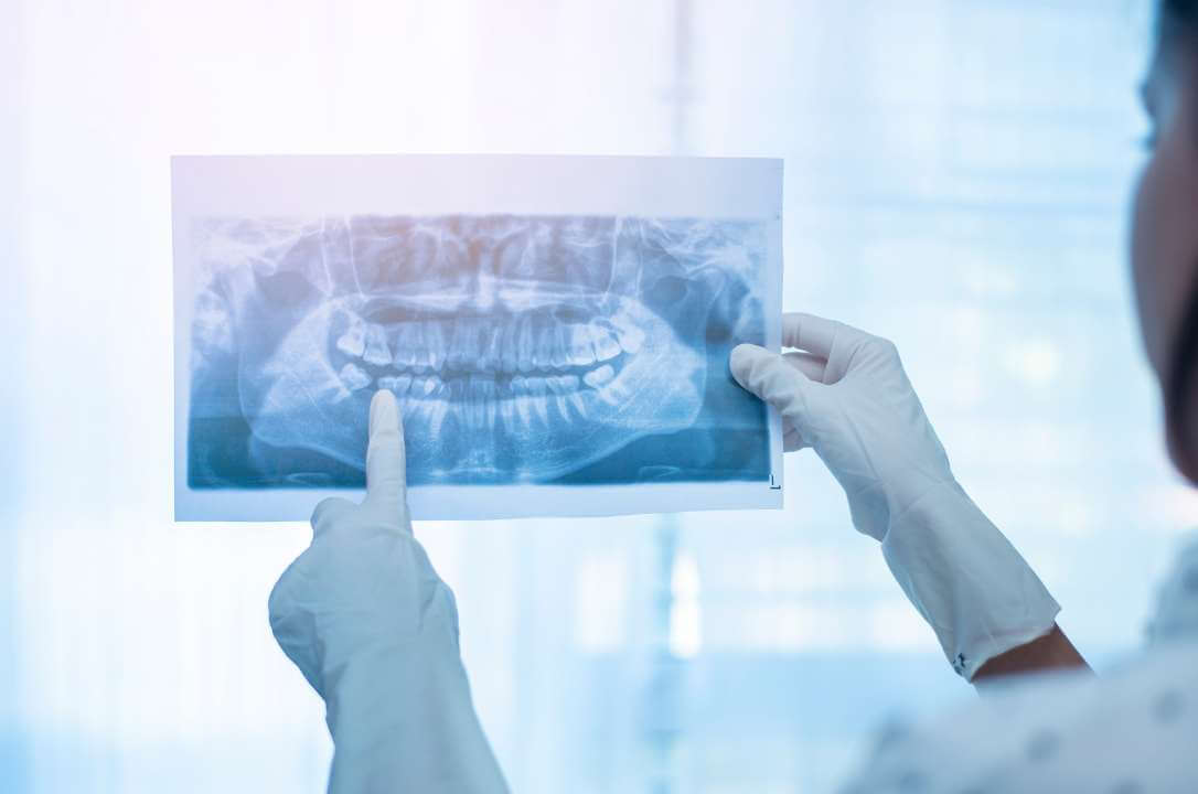 Radiologia Dental - RaioX em Araucária